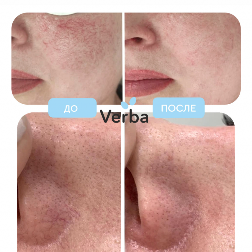 Без названия (1080 × 1080 пикс.).png Без названия (1080 × 1080 пикс.).png